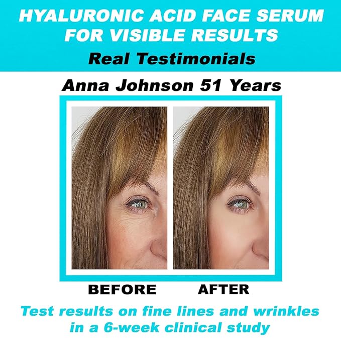 Pure Hyaluronic Acid Serum for Face Anti Aging, Fine Lines, Dark Spots, & Dry Skin 2 oz