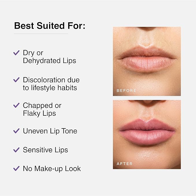 Cureskin Tinted Lip Balm for Women and Men | Hydrates & Protects for Lip Tint with Beetroot, Carrot & Strawberry | Lip Lightening Balm for Dark Lips | Tinted Lip Balm for Dark Lips to Lighten