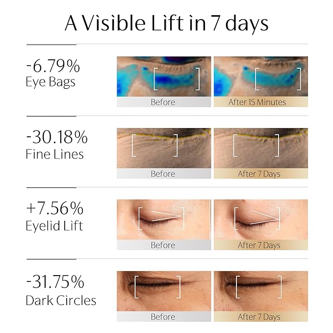 Exo Wand | Anti-Aging Electric Massage Eye Cream for Puffiness Bag Under Eye HME Exosome & PDRN Eye Tightener Cream | Caffeine, Peptide, NAD+ | for Reducing Wrinkle(0.88 oz/25g-2 Pack)