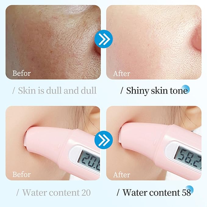 Hydrating Facial Mask Sheet Set of 5, Moisturizing Face Mask for Smooth and Supple Skin, Refreshing Self Care Beauty Probiotics One Size