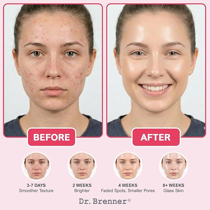 Niacinamide serum10% + TXA 4%, Tranexamic Acid Dark Spot Corrector with Zinc 1% & Arbutin 2% - Brightening Serum for Hyperpigmentation, Acne Scars, Uneven Skin Tone, Glass Skin