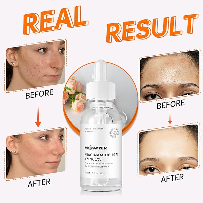 Niacinamide 10% + Zinc 1% Serum, Anti-Aging Niacinamide Serum for Face, 2PCS Moisturizing Facial Serum for All Skin Type, Women Face Skin Care.