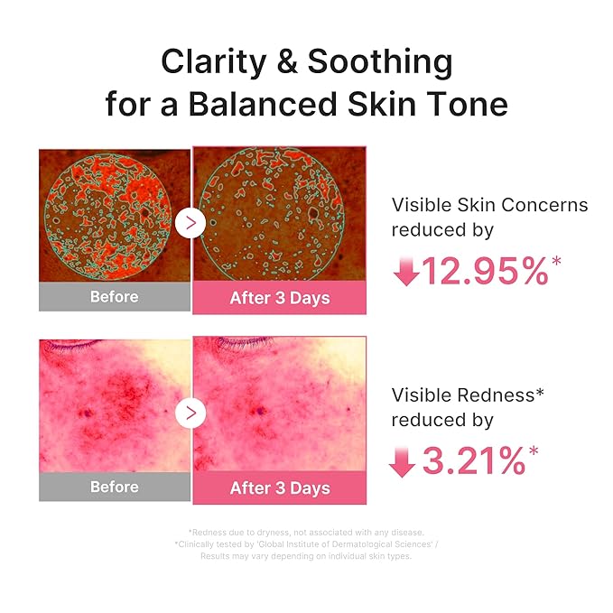 medicube PDRN Pink Peptide Serum with Salmon DNA | Ultra Light Hydrating Serum with Hyaluronic Acid | Fast-Absorbing Glow Care for Skin Clarity | Korean Skincare, 3.71 fl. Oz