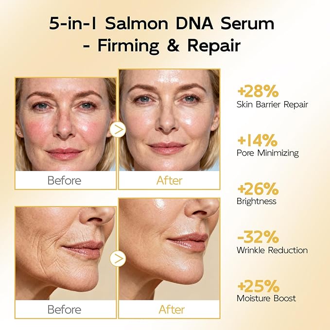 YouthVibe 0.5% PDRN Serum for Face, Anti-Aging Salmon DNA Face Serum with Hyaluronic Acid + Niacinamide + Squalane, Firming & Hydrating, Helps Smooth the Look of Fine Lines & Wrinkles, 30mL