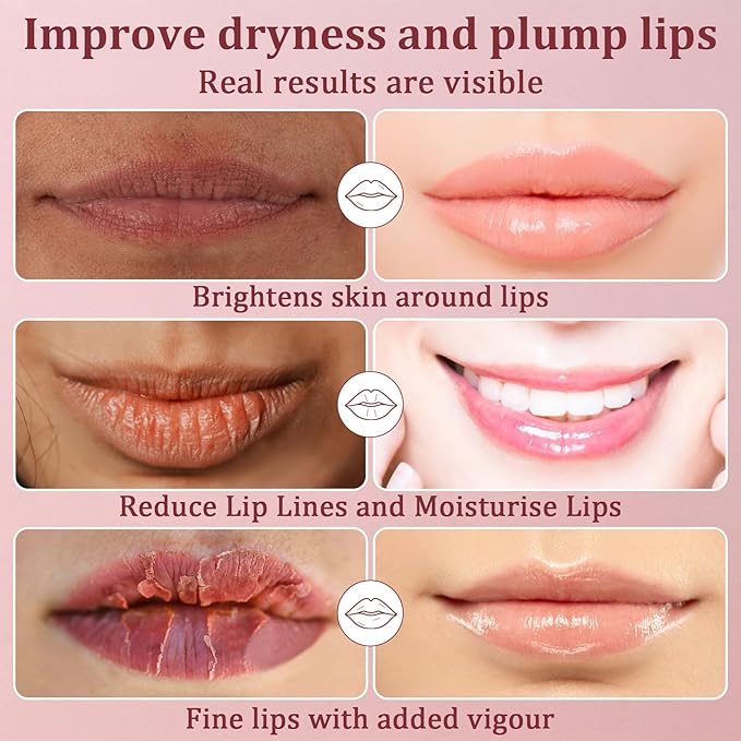 Lip Mask 30PCS Collagen Lip Masks Overnight: Hydrating Moisturizing Lip Mask Sheet Pack Bulk with Hydrogel Crystal Gold Essence - Lip Sleeping Mask for Dry Cracked Lips Women Spa Party Favors