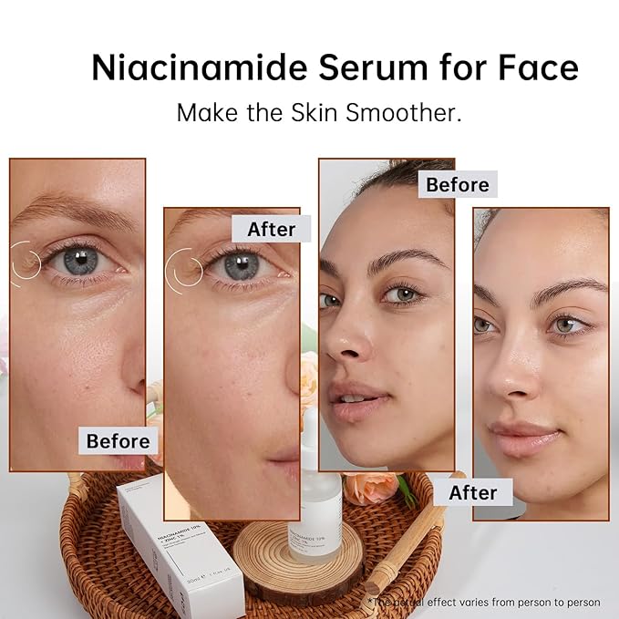 Niacinamide 10% + Zinc 1% Serum for Face, 30ML/1 Fl Oz Anti-aging Niacinamide Zinc Serum for Women, Facial Serum For Acne, Pores, Fine Lines.