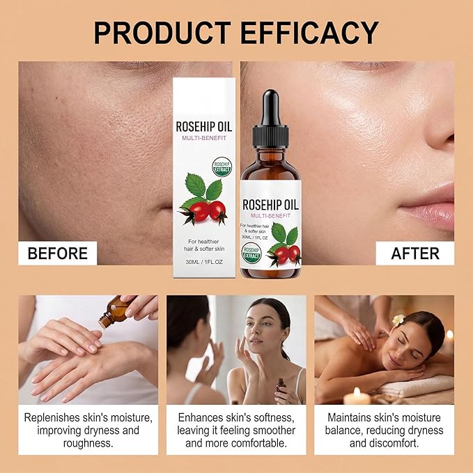 Rosehip Oil for Face, Rosehip Seed Oil, Organic Face Oil for Women, Hydrating Facial Oil for Daily Skincare, Nourishing Skin & Hair, Lightweight Moisturizing Oil (2PC)
