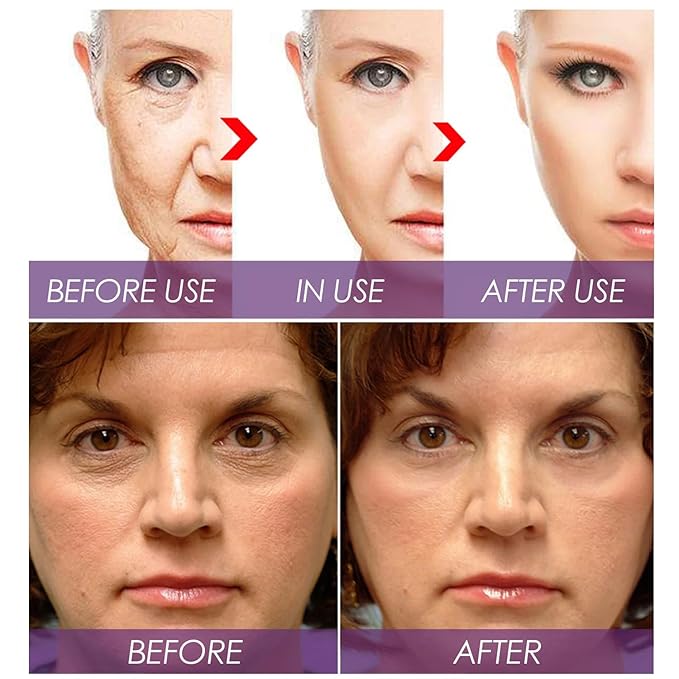 Bakuchiol Retinol Rejuvenation Serum,2025 Best Retinol Serum for Wrinkles Bakuchiol Face Korean,
