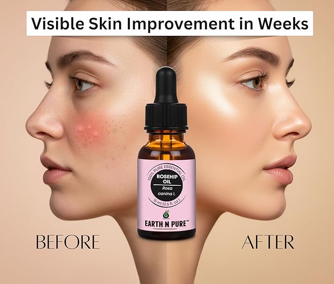 Earth N Pure Rosehip Oil Cold Pressed, Natural and Therapeutic Grade for Face with Glass Dropper - 50 ml