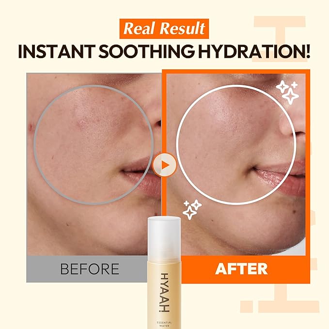 All-Day Essential Water - Korean Face Mist Spray - Hydrating Soothing with Chamomile Extract and Houttuynia Cordata - Moisturizing, Calming, Pore Care Daily Skincare, 3.38oz