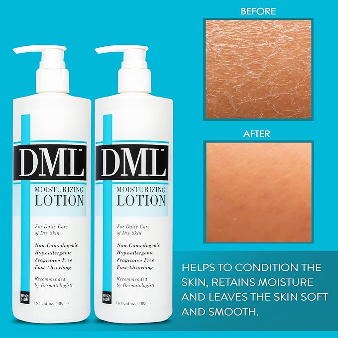DML Moisturizing Lotion- Hydrating Hand and Body Moisturizer / Hypoallergenic Body Lotion for Dry and Cracked Skin / Gentle, Unscented Moisturizing Lotion Great for Men and Women / 16 oz (Pack of 2)