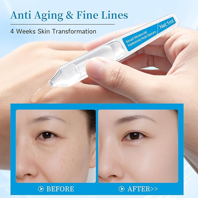 Hyaluronic Acid Serum – Ultra Hydrating Serum for Plumper Skin Daily Pre-Makeup Skincare Not Sticky Hyaluronic Acid Ampoules, Suitable for Dry & Sensitive Skin Single-Use 15PCS