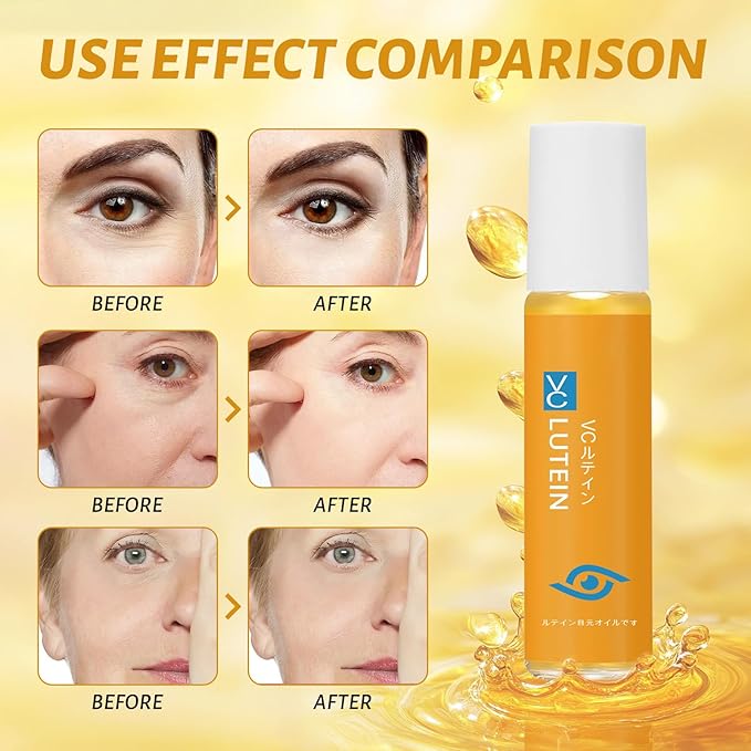 3PCS Lutein Eye Essence Oil, New Upgrade VC Lutein Anti-Wrinkle EyeSerum, Ruy Eye Oil 𝐯𝐜, Improve Eyes Bags Dark Circles for Women Men