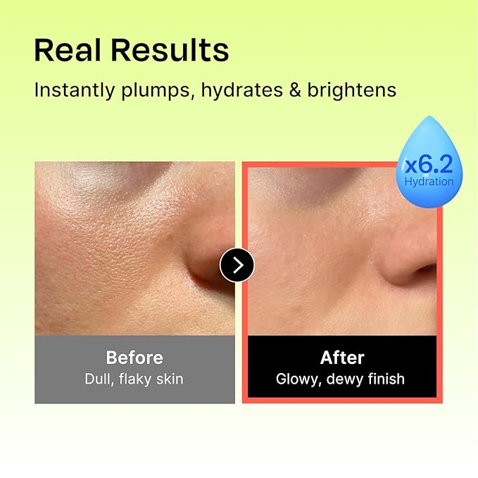 Celladix Hyaluronic Intense Serum – 95% Pure Hyaluronic Acid with Jeju Deep Sea Water & Peptides – 100 Hours of Hydration, Gentle Soothing Care for Radiant Skin – Korean Skincare, 1.01 Fl Oz