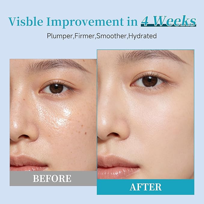 Collagen Peptide Anti-Aging Serum with PDRN – Triple Collagen, Peptide Complex & Botanical Extracts for Firming, Hydration & Skin Barrier Repair – Ampoule Serum Set 1.5ml x 30