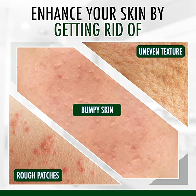 GLY MIRACLE Fragrance-Free Non-Greasy Body Lotion, 16 oz High-Glycerin Moisturizer for Sensitive, Extremely Dry Skin, Hands, Feet & Body