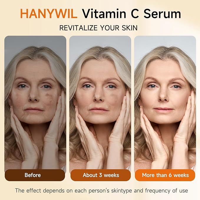 HANYWIL 20% Super Vitamin C Serum for Mature Skin, Targets Age Spot & Wrinkle Reduction with Hyaluronic Acid, Hydrating Anti-Age Serum 1.7fl oz