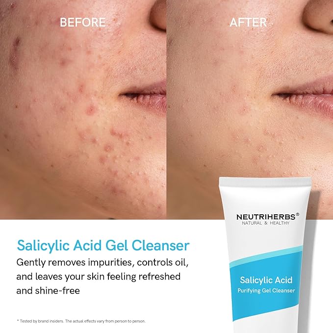 Neutriherbs Salicylic Acid Gel Cleanser, Acne Prone Oil Control Face Wash, Unclog Pore, Remove Blackhead Facial Wash - 4oz