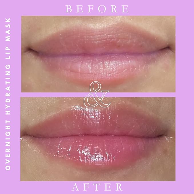 Nourishing & Repairing Overnight Lip Mask, Lip balm Vegan Deep Hydration with Mineral-Rich Formula, Waterproof.35oz (Rose, flavor)