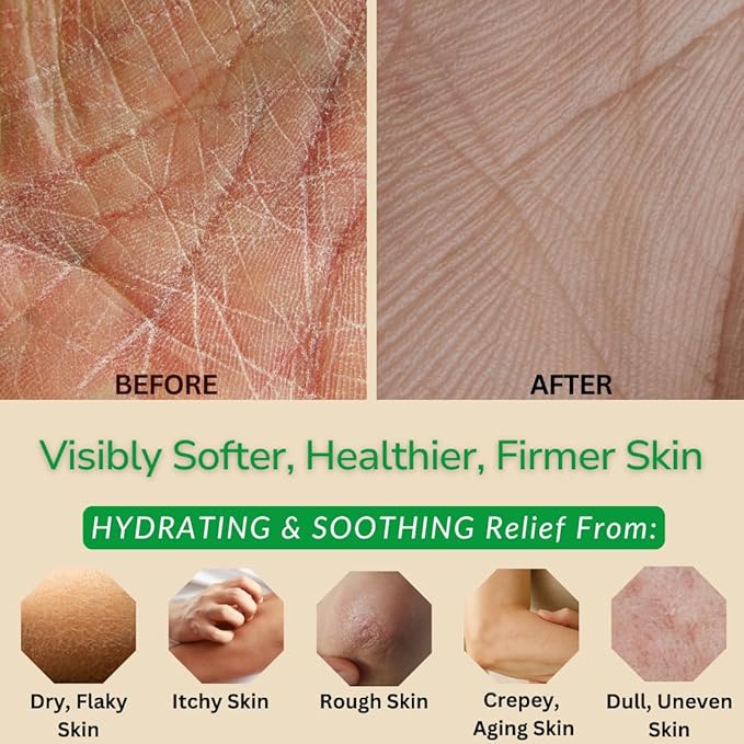 Coconut & Pineapple Fusion Hand & Body Lotion, Natural Dry Skin Moisturizer for All Skin Types, Aloe Vera, Coconut Oil, Ceramides, Vitamin B5, Vitamin E, 8 oz