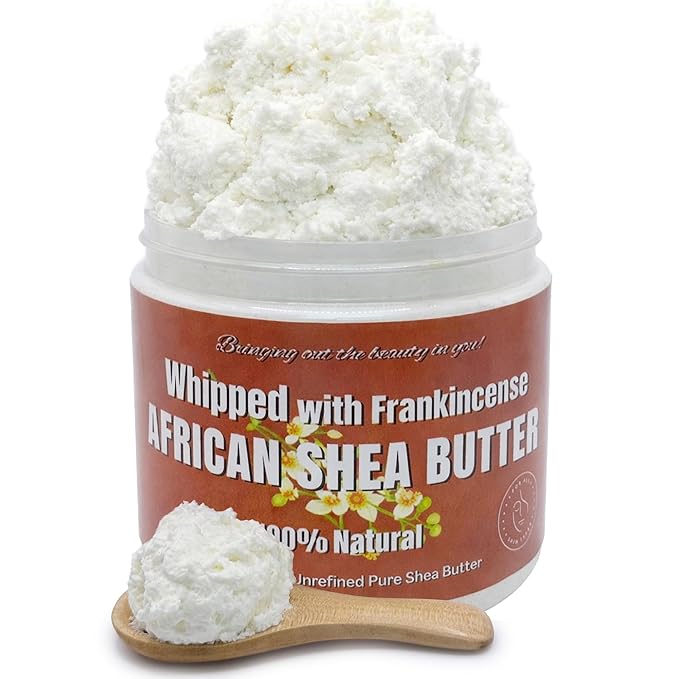 RA COSMETICS Whipped African Shea Butter with Frankincense – 100% Whipped Shea Body Butter from Ghana – Moisturizing Natural Skincare for Dry Skin, Hair, Scalp – Nourishes, Softens & Hydrates – 12oz