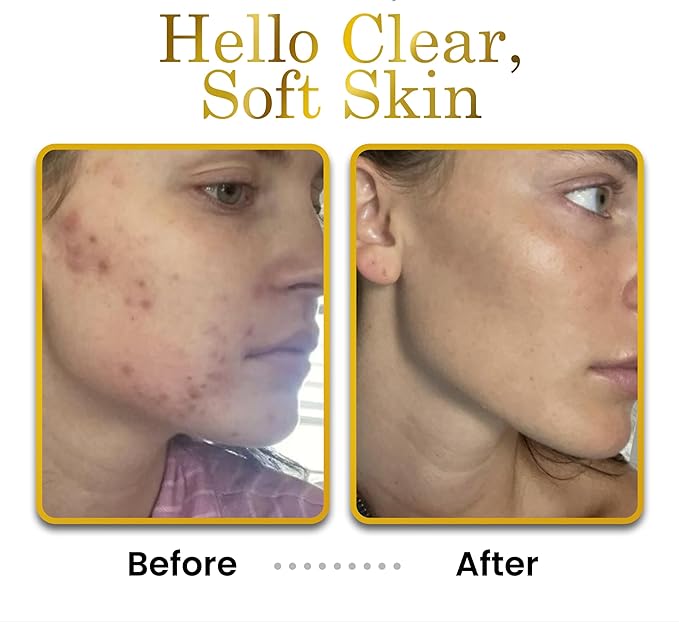 Non-Greasy Hyaluronic Acid Moisturizer - Unscented Face Moisturizer & Unscented Lotion - No Fillers, Organic & Plant-Based Hyaluronic Acid Lotion - Anti-Aging Face Moisturizer – Travel Size