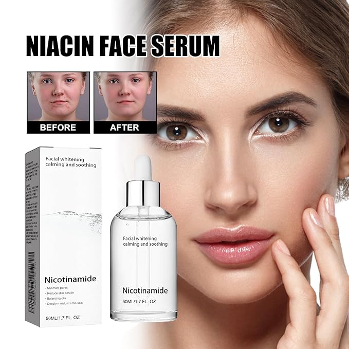 Generic Niacinamide Freckles Removal Serum, Sunnylas Niacinamide Freckles Removal Serum, Niacinamide Serum for Face and Body, Nicotinamide Serum for Blemishes, for All Type Skin (3PCS)