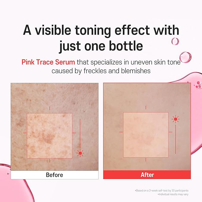PDRN Serum TXA 5% Niacinamide 10% Pink – Korean Skincare Dark Spot, Hyaluronic Acid, Vitamin B5, Panthenol, Ceramide – Uneven Skin Tone Radiant Complexion, Glass Skin (30ml / 1.01 fl oz)