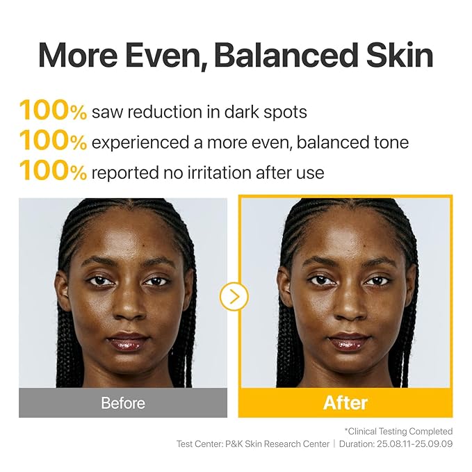 numbuzin No.5 Glutathione TXA Dark Spot Ampoule, Targeted Tone Care Concentrate for Dark Spots & Uneven Skin, Tranexamic Acid, Niacinamide, Vitamin Tree Water, Korean Skincare, 10.7g