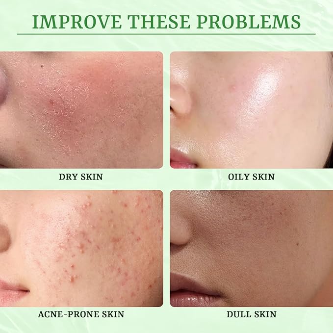 Anti Acne Face Mask Salicylic Acid Face Masks Skincare, Hydrating Face Masks, Soothing Facial Sheet Masks Skin Care for Acne Prone, Acne Mask for Pimple Breakouts Oil Control, 10 Pack