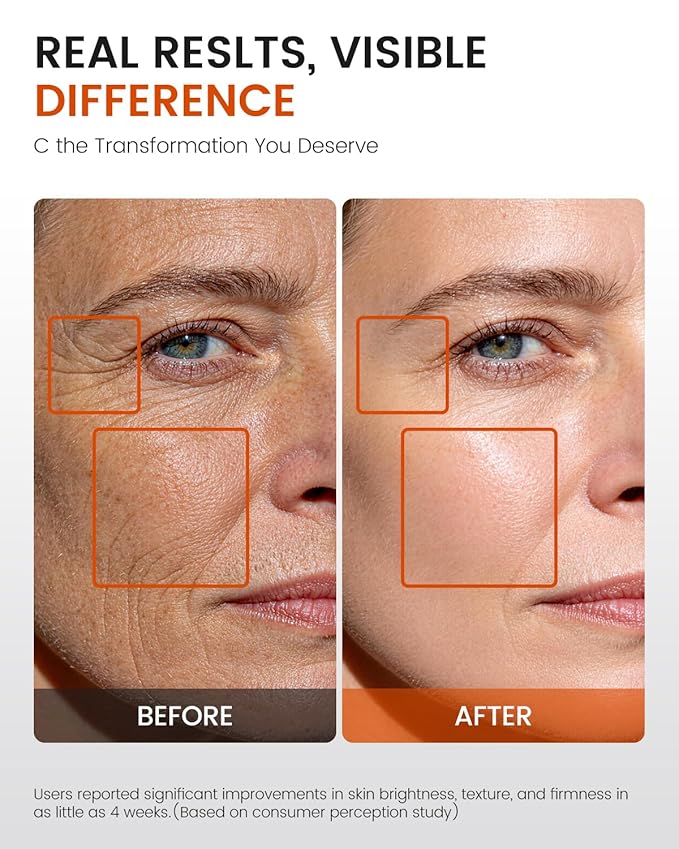 Super C Serum for Mature Skin – All-in-One Vitamin C Serum for Face with Retinol & Hyaluronic Acid for Women Over 60 & 70 – Anti-Aging Hydrating Serum for Dark Spots, Wrinkles & Fine Lines 2.0 fl. oz.