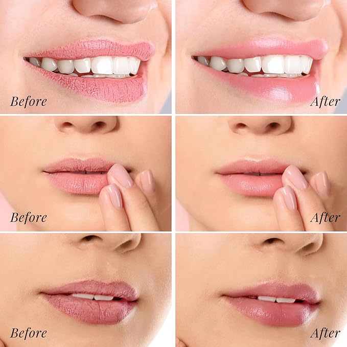 ANRCOLLECT Lip Care Set - Exfoliating Scrub + 3 Overnight Masks for Soft, Hydrated Lips, 4-Pack Gift Set