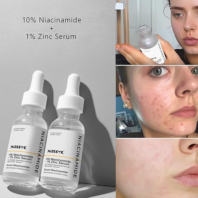 Niacinamide 10% + Zinc 1% Face Serum for Women, 2 PCS Refreshing Niacinamide Facial Serum For Acne.