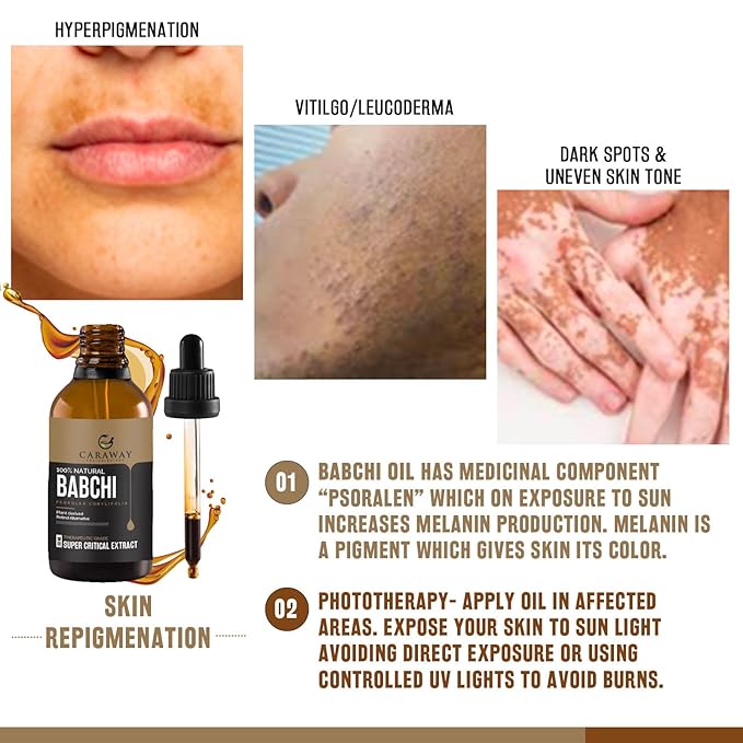 CARAWAY BAKUCHI OIL - Supercritical CO2 Extract| Pure Babchi Oil for Skin, Pigmentation, Vitiligo & Uneven skin tone| Bakuchi Seed Oil – 50ml