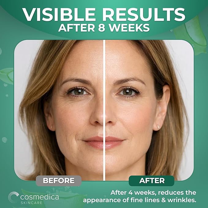 Cosmedica Skincare Retinol Serum 2.5% | Hydrating Vitamin A Serum with Green Tea Hyaluronic Acid Vitamin E | Non-Irritating Serum for Sensitive Skin Oily Skin | 1oz