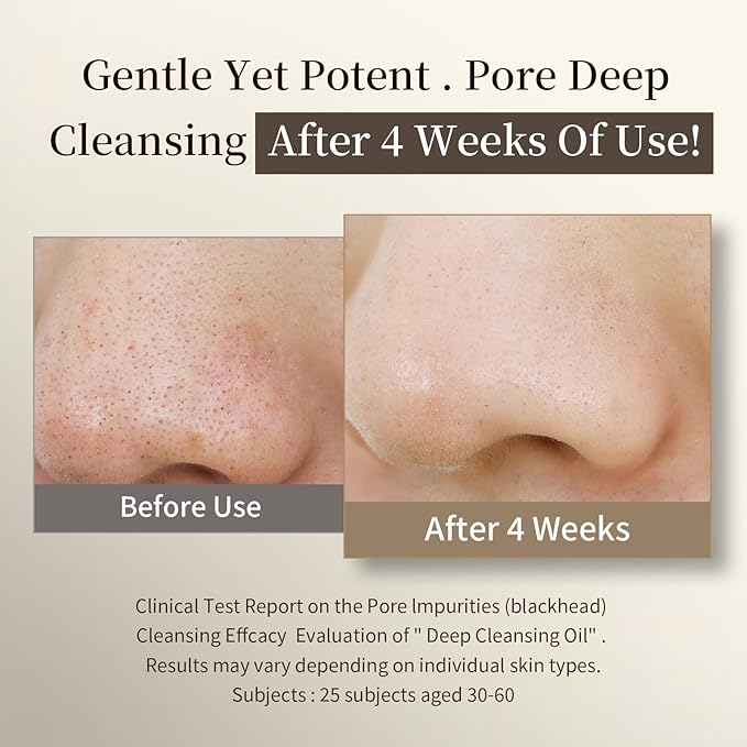 COSMOO Deep Cleansing Oil, Pore Control Oil Cleanser for Face, Makeup Blackhead Remover, Korean Skin Care, All Skin Types - 200ml