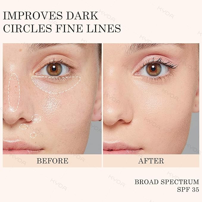 KYDA Mineral Eye Cream, Tined Eye Cream Color Corrector, 3-in-1 Anti-Aging Eye Cream for Dark Circle and Fine Lines, SPF 35, Fair