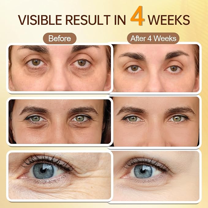 5% Caffeine Eye Cream for Puffy Eyes - Under Eye Brightener Serum Roller for Dark Circles Wrinkles Bags Puffiness, with 360° Massage Cooling Ball, Travel Toiletries (15ml / 0.51fl oz)