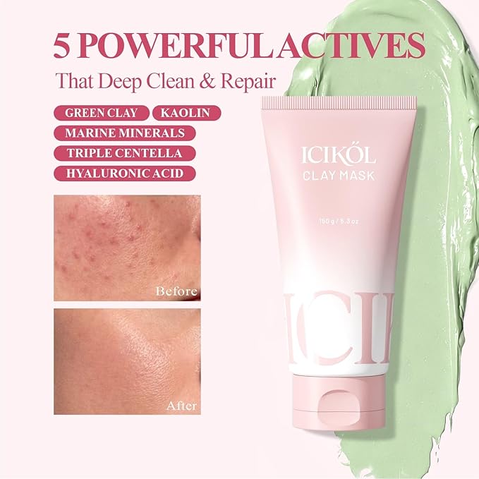 Deep Cleansing Green Clay Face Mask, with Marine Minerals & Repair Mud, 5.3 oz Large Size – Hydrating Mud Mask with Brush, Zero Pore Blackhead Mud Facial Mask for All Skin Types