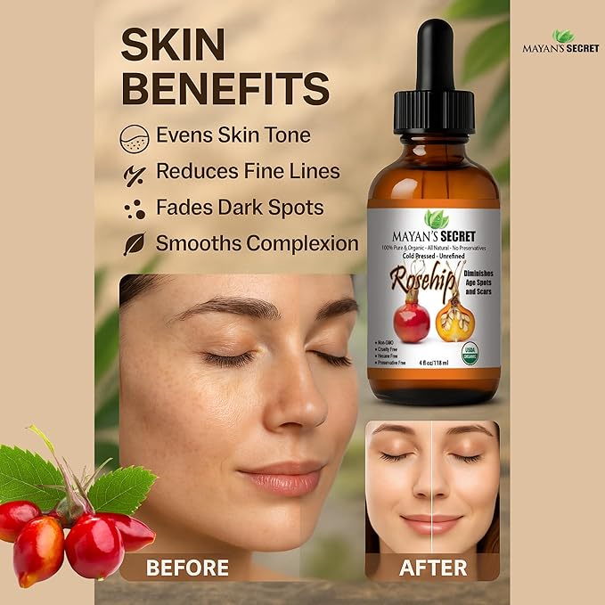 Rosehip Oil - Virgin Organic 100% Pure, Cold Pressed, Unrefined.- 4oz