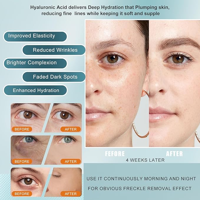 Super Vitamin C Serum for face, with Hyaluronic Acid & Peptides - Anti Aging Face Serum for Women & Men, Dark Spot Corrector for Firming, Hydrating Treatment to Reduce Wrinkles & Fine Lines, 1 fl oz