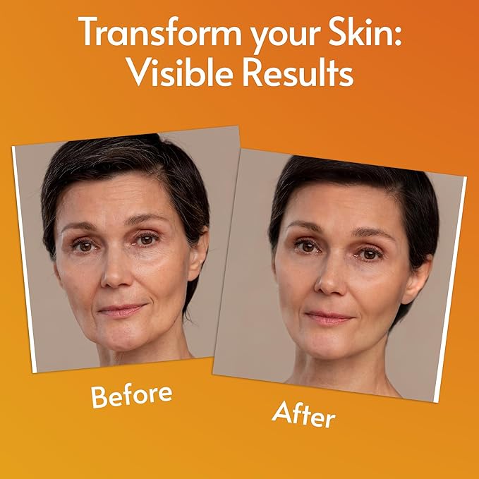 Sylk Vitamin C Serum For Face with Hyaluronic Acid & Vitamin E – Brightening Serum – Treatment for Anti Aging, Dark Spots, Tone, Fine Lines & Wrinkles - Microneedling - Korean Skincare - 2 fl oz