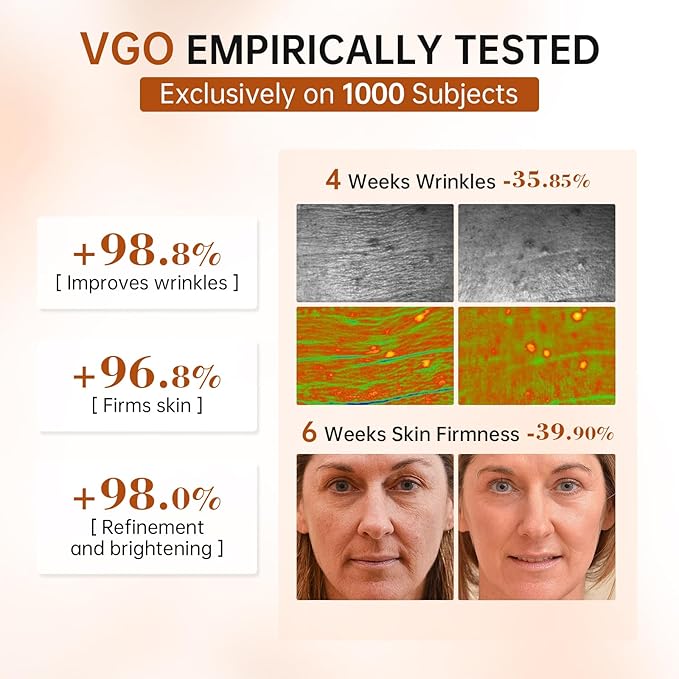 VGO Retinol Serum for Face, Resurfacing Retinol Serum with Hyaluronic Acid, Niacinamide and Ceramides, Hydrating and Refreshing, Wrinkle Smoothing, Suitable for Sensitive Skin (1 pack)