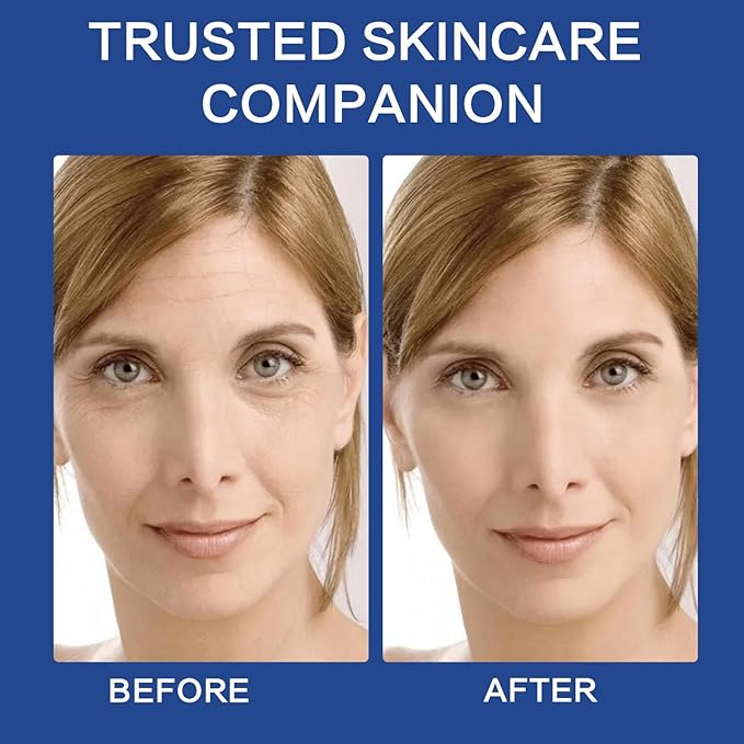 ABOTE 2.3% Hyaluronic Acid Facial Serum Moisturizing for Face Plump Skin Moisturizing Moisturize Smoothes Wrinkles (3 Pack 1FL.OZ|30ml Each)