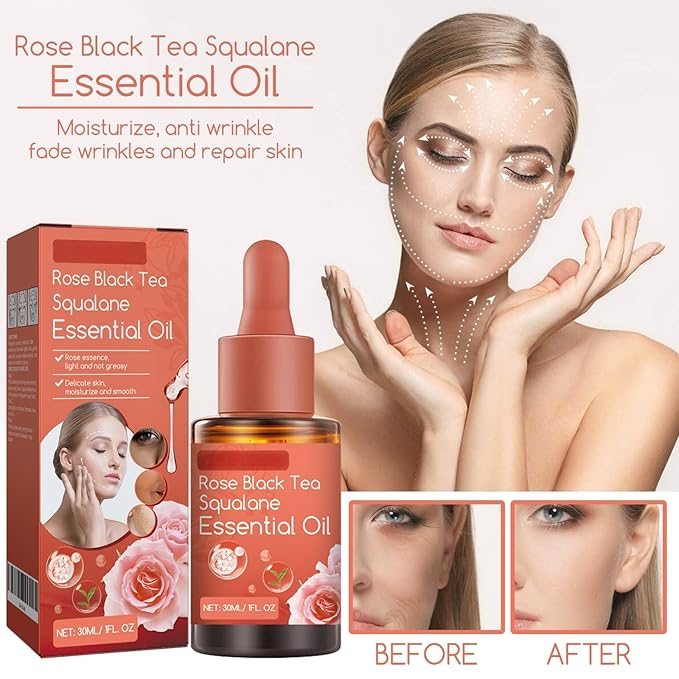 Rose Black Tea Squalane Essential Oil, Squalane Rose Oil for Face, Hydrating Facial Oil, Face Anti Aging, Reduce Wrinkles & Fine Lines, Tighten Skin, Deep Hydration