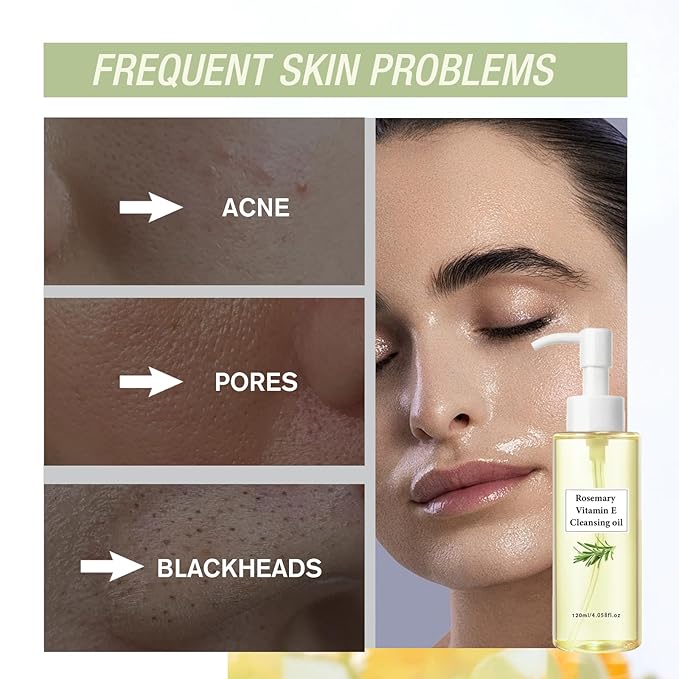 Rosemary Vitamin E Cleansing Oil For Pores, Plant-Based Makeup Remover Deep Cleanses And Nourishes Skin.120ml.