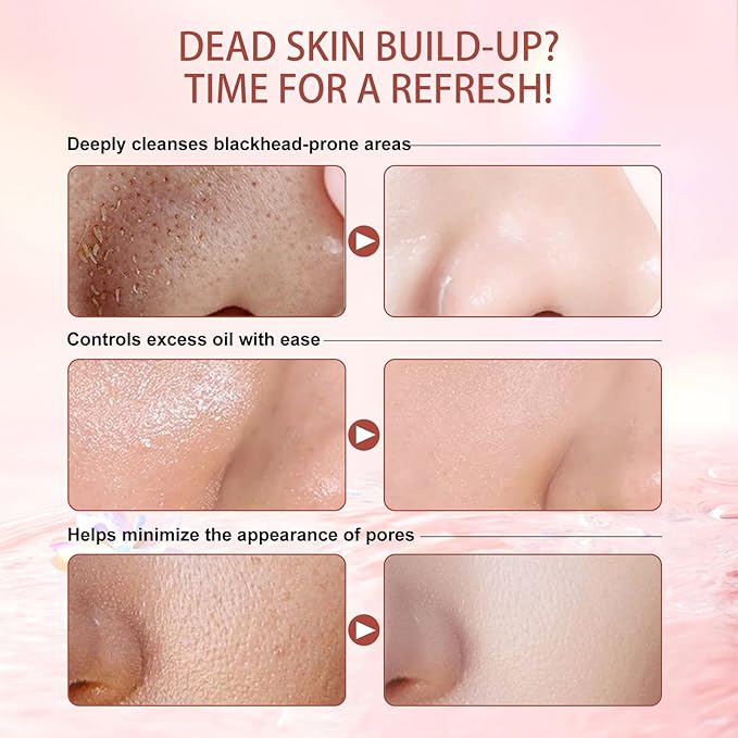 Purifying Exfoliating Gel, Facial Exfoliator Cleanser, Face Scrub, Natural Exfoliating Gel Purifying Cream, Gentle for Face Body, Deep Cleansing for All Skin (2PCS)
