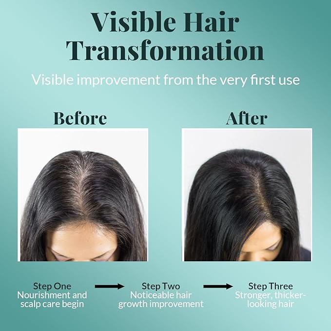 AVD Organics Rosemary Oil for Hair Growth & Scalp | Infused with Boitin | Hair Stregthening Nourishing and Volumizing | Infused with Jojoba & Castor Oil | Non - GMO 120ml