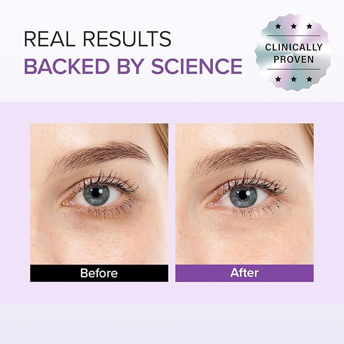 Mary&May Tranexamic Acid + Glutathione Eye Cream (30ml) - Korean Skincare for Dark Circles & Uneven tone - Fragrance-Free Under Eye Cream for Dark Spots & Hyperpigmentation 1.01oz.