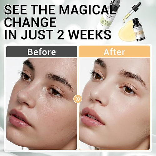 23% Vitamin C Serum 6 Peptide Booster Serum Set - Korean Skin Care Set for Deep Hydrating, Anti-Aging & Wrinkle-Reducing, Improves Skin Elasticity & Tone - Ideal Gift Set for Women